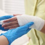 BurnInjury